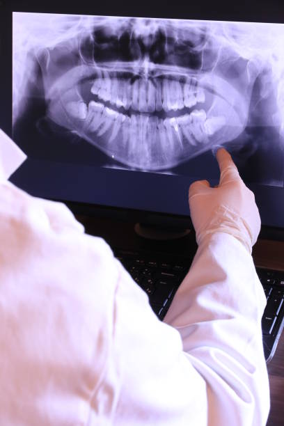 Best Emergency Gum Treatment in El Portal, FL